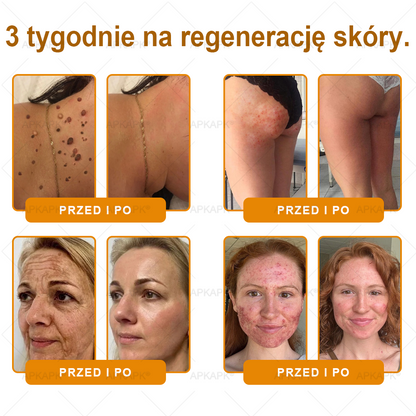 ✨ΑPΚΑPK® Jad Pszczoły Kompleksowy Krem✨pomaga w leczeniu problemów skórnych, takich jak: zmarszczki, blizny, plamy pigmentacyjne, rozstępy, trądzik, łuszczyca, egzema, zmiany skórne, podrażnienia, stany zapalne i inne problemy skórne🫏