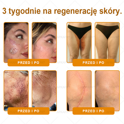 ✨ΑPΚΑPK® Jad Pszczoły Kompleksowy Krem✨pomaga w leczeniu problemów skórnych, takich jak: zmarszczki, blizny, plamy pigmentacyjne, rozstępy, trądzik, łuszczyca, egzema, zmiany skórne, podrażnienia, stany zapalne i inne problemy skórne🫏