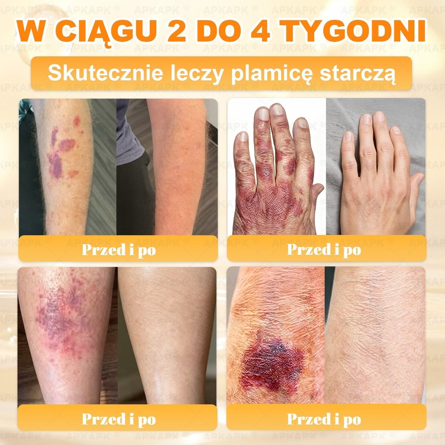 ✨ΑPΚΑPK® Jad Pszczoły Kompleksowy Krem✨pomaga w leczeniu problemów skórnych, takich jak: zmarszczki, blizny, plamy pigmentacyjne, rozstępy, trądzik, łuszczyca, egzema, zmiany skórne, podrażnienia, stany zapalne i inne problemy skórne🫏
