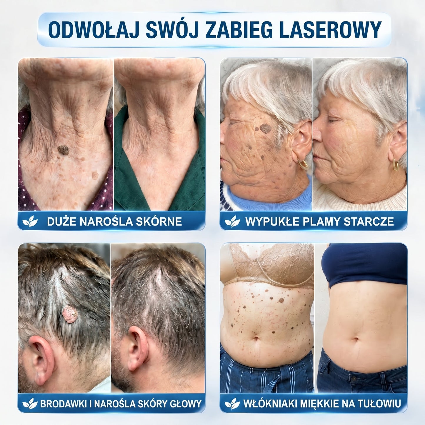✅✨𝐎𝐟𝐢𝐜𝐣𝐚𝐥𝐧𝐲 𝐬𝐤𝐥𝐞𝐩 𝐦𝐚𝐫𝐤𝐢  𝐏𝐢𝐜𝐝𝐨®   𝟕-𝐃𝐧𝐢𝐨𝐰𝐲 𝐖𝐲𝐦𝐚𝐳𝐲𝐰𝐚𝐜𝐳 𝐙𝐧𝐚𝐦𝐢𝐨𝐧 𝐢 𝐏𝐥𝐚𝐦(Bezbolesny aplikator kulkowy, niepozostawiający śladów)