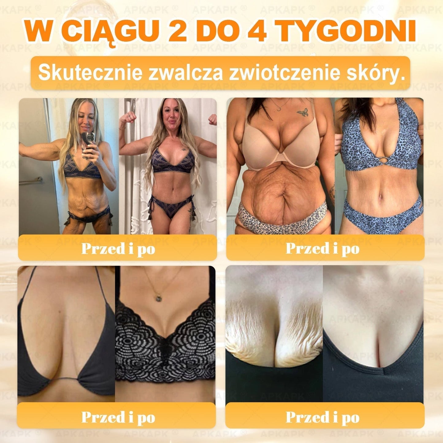 ✨ΑPΚΑPK® Jad Pszczoły Kompleksowy Krem✨pomaga w leczeniu problemów skórnych, takich jak: zmarszczki, blizny, plamy pigmentacyjne, rozstępy, trądzik, łuszczyca, egzema, zmiany skórne, podrażnienia, stany zapalne i inne problemy skórne🫏