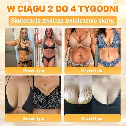 ✨ΑPΚΑPK® Jad Pszczoły Kompleksowy Krem✨pomaga w leczeniu problemów skórnych, takich jak: zmarszczki, blizny, plamy pigmentacyjne, rozstępy, trądzik, łuszczyca, egzema, zmiany skórne, podrażnienia, stany zapalne i inne problemy skórne🫏