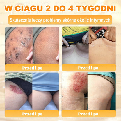 ✨ΑPΚΑPK® Jad Pszczoły Kompleksowy Krem✨pomaga w leczeniu problemów skórnych, takich jak: zmarszczki, blizny, plamy pigmentacyjne, rozstępy, trądzik, łuszczyca, egzema, zmiany skórne, podrażnienia, stany zapalne i inne problemy skórne🫏