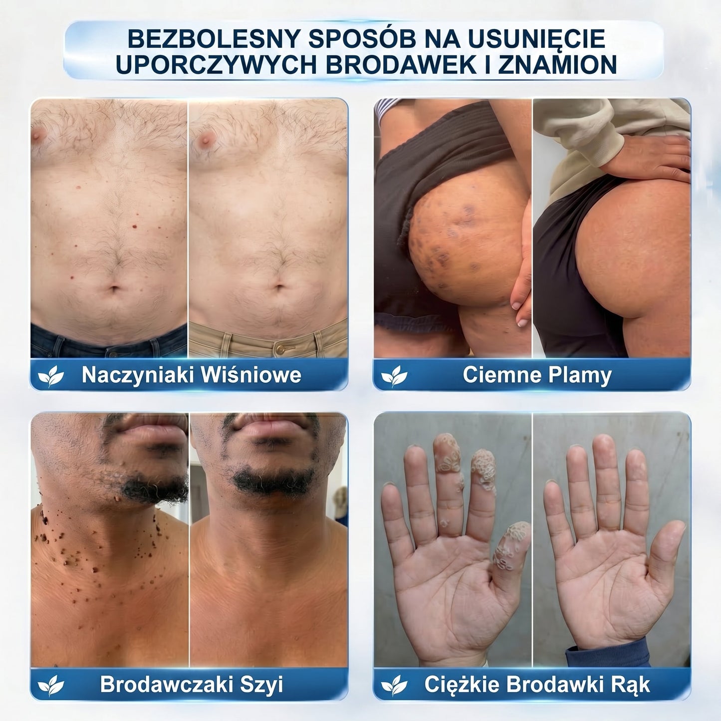 ✅✨𝐎𝐟𝐢𝐜𝐣𝐚𝐥𝐧𝐲 𝐬𝐤𝐥𝐞𝐩 𝐦𝐚𝐫𝐤𝐢  𝐏𝐢𝐜𝐝𝐨®   𝟕-𝐃𝐧𝐢𝐨𝐰𝐲 𝐖𝐲𝐦𝐚𝐳𝐲𝐰𝐚𝐜𝐳 𝐙𝐧𝐚𝐦𝐢𝐨𝐧 𝐢 𝐏𝐥𝐚𝐦(Bezbolesny aplikator kulkowy, niepozostawiający śladów)