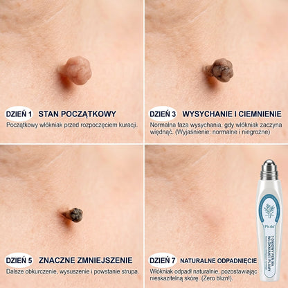 ✅✨𝐎𝐟𝐢𝐜𝐣𝐚𝐥𝐧𝐲 𝐬𝐤𝐥𝐞𝐩 𝐦𝐚𝐫𝐤𝐢  𝐏𝐢𝐜𝐝𝐨®   𝟕-𝐃𝐧𝐢𝐨𝐰𝐲 𝐖𝐲𝐦𝐚𝐳𝐲𝐰𝐚𝐜𝐳 𝐙𝐧𝐚𝐦𝐢𝐨𝐧 𝐢 𝐏𝐥𝐚𝐦(Bezbolesny aplikator kulkowy, niepozostawiający śladów)