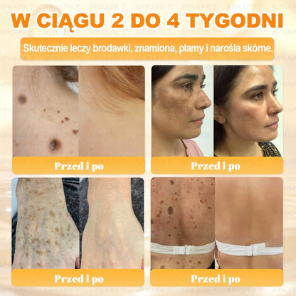✨ΑPΚΑPK® Jad Pszczoły Kompleksowy Krem✨pomaga w leczeniu problemów skórnych, takich jak: zmarszczki, blizny, plamy pigmentacyjne, rozstępy, trądzik, łuszczyca, egzema, zmiany skórne, podrażnienia, stany zapalne i inne problemy skórne🫏